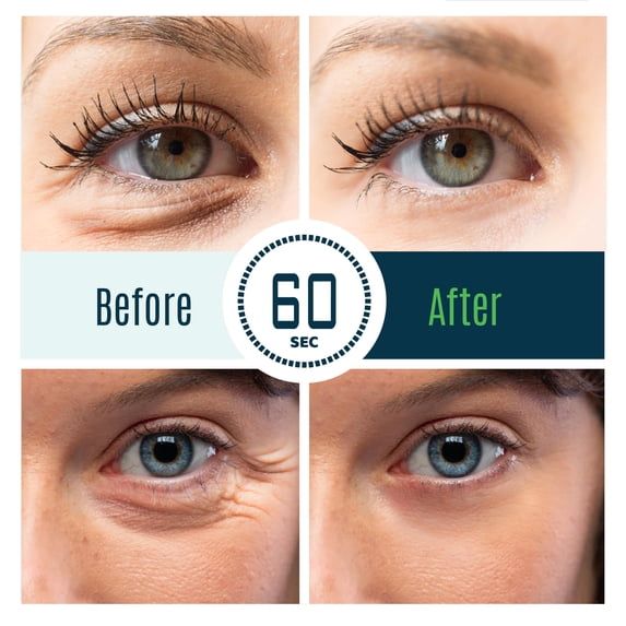 Dermaxgen  INSTANT EYEBAG REMOVER - TIME REVERSE- Visibly Reduce Under-Eye Bags, Wrinkles, Dark Circles, Fine Lines & Crow's Feet Instantly