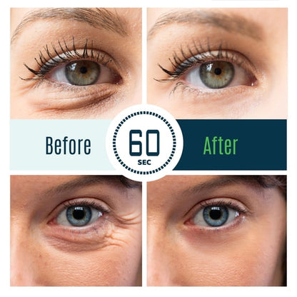 Dermaxgen  INSTANT EYEBAG REMOVER - TIME REVERSE- Visibly Reduce Under-Eye Bags, Wrinkles, Dark Circles, Fine Lines & Crow's Feet Instantly
